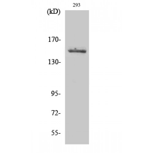 TYK2 Antibody - Western blot of Tyk 2 antibody