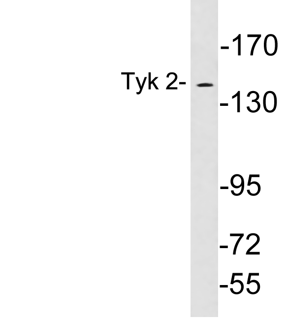 TYK2 Antibody - Western blot analysis of lysates from 293 cells, using Tyk 2 antibody.