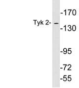 TYK2 Antibody - Western blot analysis of lysates from 293 cells, using Tyk 2 antibody.