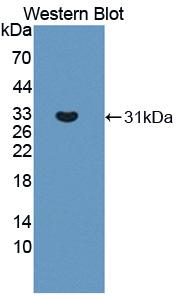 TYK2 Antibody - Western blot of TYK2 antibody.