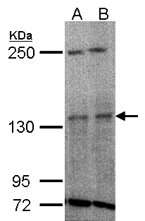 TYK2 Antibody - Sample (30 ug whole cell lysate). A: H1299, B: HeLa S3. 5% SDS PAGE. TYK2 antibody diluted at 1:1000