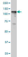 TYK2 Antibody - TYK2 monoclonal antibody (M02), clone 5A4 Western blot of TYK2 expression in HeLa NE.
