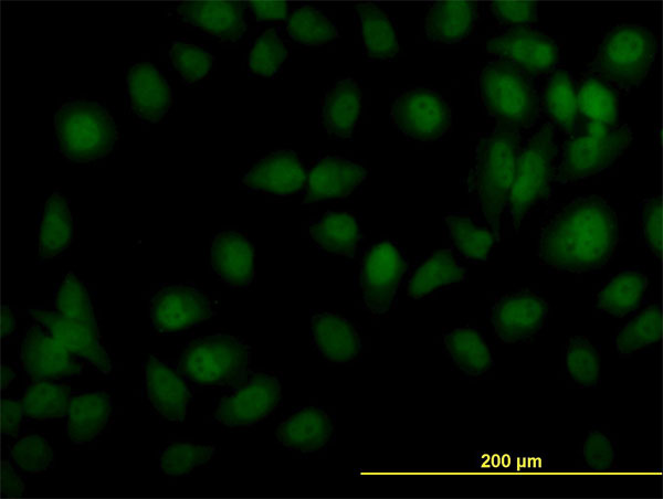 TYK2 Antibody - Immunofluorescence of monoclonal antibody to TYK2 on HeLa cell. [antibody concentration 10 ug/ml]
