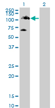 TYK2 Antibody - Western blot of TYK2 expression in transfected 293T cell line by TYK2 monoclonal antibody (M01), clone 6G12.