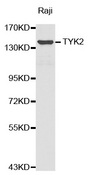 TYK2 Antibody - Western blot analysis of extracts of Raji cell lines.