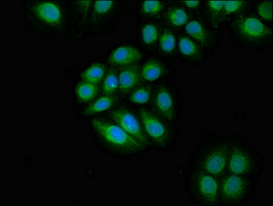 TYK2 Antibody - Immunofluorescent analysis of A549 cells diluted at 1:100 and Alexa Fluor 488-congugated AffiniPure Goat Anti-Rabbit IgG(H+L)