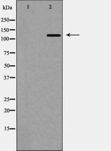 TYK2 Antibody - Western blot analysis of TYK2 expression in 293 cells. The lane on the left is treated with the antigen-specific peptide.