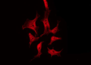 TYK2 Antibody - Staining 293 cells by IF/ICC. The samples were fixed with PFA and permeabilized in 0.1% Triton X-100, then blocked in 10% serum for 45 min at 25°C. The primary antibody was diluted at 1:200 and incubated with the sample for 1 hour at 37°C. An Alexa Fluor 594 conjugated goat anti-rabbit IgG (H+L) Ab, diluted at 1/600, was used as the secondary antibody.