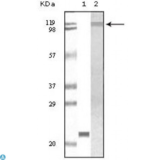 TYK2 Antibody - Western Blot (WB) analysis using Tyk 2 Monoclonal Antibody against truncated TYK2 recombinant protein (1) and Jurkat cell lysate(2).