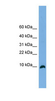 TYMSOS Antibody - C18orf56 antibody Western blot of Fetal Brain lysate. This image was taken for the unconjugated form of this product. Other forms have not been tested.