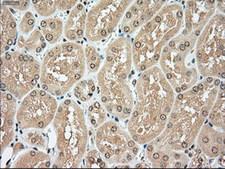 TYRO3 Antibody - IHC of paraffin-embedded Kidney tissue using anti-TYRO3 mouse monoclonal antibody. (Dilution 1:50).