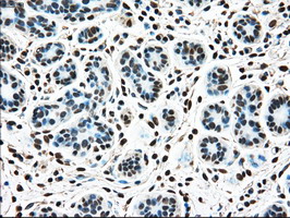 TYRO3 Antibody - IHC of paraffin-embedded breast tissue using anti-TYRO3 mouse monoclonal antibody. (Dilution 1:50).