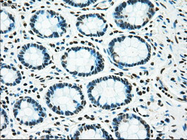 TYRO3 Antibody - IHC of paraffin-embedded colon tissue using anti-TYRO3 mouse monoclonal antibody. (Dilution 1:50).