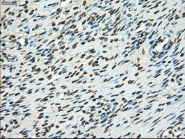 TYRO3 Antibody - IHC of paraffin-embedded Ovary tissue using anti-TYRO3 mouse monoclonal antibody. (Dilution 1:50).