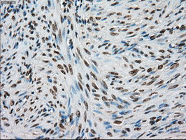 TYRO3 Antibody - IHC of paraffin-embedded endometrium tissue using anti-TYRO3 mouse monoclonal antibody. (Dilution 1:50).