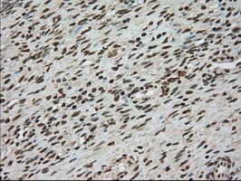 TYRO3 Antibody - IHC of paraffin-embedded Ovary tissue using anti-TYRO3 mouse monoclonal antibody. (Dilution 1:50).