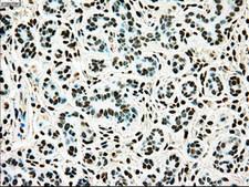 TYRO3 Antibody - IHC of paraffin-embedded breast tissue using anti-TYRO3 mouse monoclonal antibody. (Dilution 1:50).