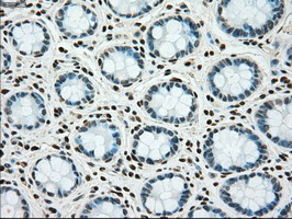 TYRO3 Antibody - IHC of paraffin-embedded colon tissue using anti-TYRO3 mouse monoclonal antibody. (Dilution 1:50).