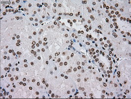 TYRO3 Antibody - IHC of paraffin-embedded Kidney tissue using anti-TYRO3 mouse monoclonal antibody. (Dilution 1:50).