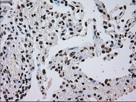 TYRO3 Antibody - IHC of paraffin-embedded lung tissue using anti-TYRO3 mouse monoclonal antibody. (Dilution 1:50).