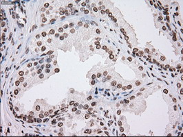 TYRO3 Antibody - IHC of paraffin-embedded prostate tissue using anti-TYRO3 mouse monoclonal antibody. (Dilution 1:50).