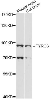 TYRO3 Antibody - Western blot analysis of extracts of various cell lines, using TYRO3 antibody at 1:1000 dilution. The secondary antibody used was an HRP Goat Anti-Rabbit IgG (H+L) at 1:10000 dilution. Lysates were loaded 25ug per lane and 3% nonfat dry milk in TBST was used for blocking. An ECL Kit was used for detection and the exposure time was 90s.