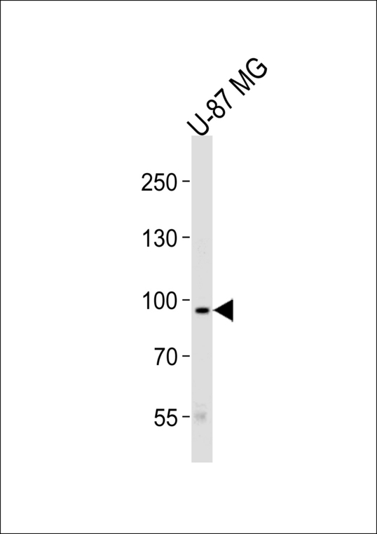 TYRO3 Antibody - Western blot of lysate from U-87 MG cell line, using TYRO3 Antibody. Antibody was diluted at 1:1000 at each lane. A goat anti-rabbit IgG H&L (HRP) at 1:5000 dilution was used as the secondary antibody. Lysate at 35ug per lane.