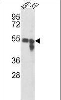 Tyrosinase Antibody - Western blot of Tyrosinase Antibody in A375, 293 cell line lysates (35 ug/lane). Tyrosinase (arrow) was detected using the purified antibody.