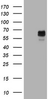 Tyrosinase Antibody - HEK293T cells were transfected with the pCMV6-ENTRY control (Left lane) or pCMV6-ENTRY TYR (Right lane) cDNA for 48 hrs and lysed. Equivalent amounts of cell lysates (5 ug per lane) were separated by SDS-PAGE and immunoblotted with anti-TYR.