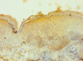 Tyrosinase Antibody - Immunohistochemistry of paraffin-embedded human skin using antibody at 1:100 dilution.  This image was taken for the unconjugated form of this product. Other forms have not been tested.