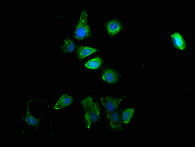 Tyrosinase Antibody - Immunofluorescence staining of MCF-7 cells with TYR Antibody at 1:100, counter-stained with DAPI. The cells were fixed in 4% formaldehyde, permeabilized using 0.2% Triton X-100 and blocked in 10% normal Goat Serum. The cells were then incubated with the antibody overnight at 4°C. The secondary antibody was Alexa Fluor 488-congugated AffiniPure Goat Anti-Rabbit IgG(H+L).