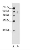 Tyrosinase Antibody - A: Marker, B: Jurkat Cell Lysate.  This image was taken for the unconjugated form of this product. Other forms have not been tested.