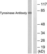 Tyrosinase Antibody - Western blot analysis of lysates from COS7 cells, treated with UV 30', using Tyrosinase Antibody. The lane on the right is blocked with the synthesized peptide.