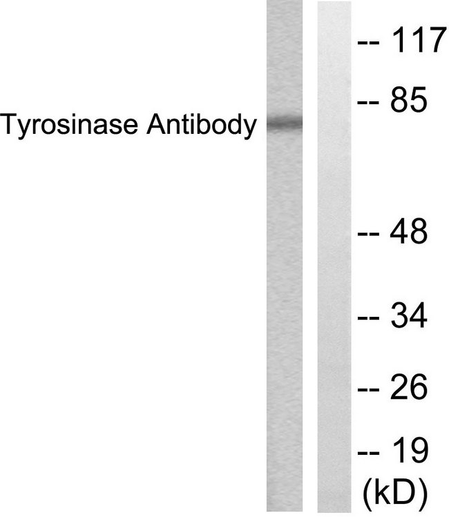 Tyrosinase Antibody - Western blot analysis of lysates from COS7 cells, treated with UV 30', using Tyrosinase Antibody. The lane on the right is blocked with the synthesized peptide.