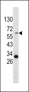 Tyrosinase Antibody - Western blot of Tyrosinase antibody in HepG2 cell line lysates (35 ug/lane). Tyrosinase (arrow) was detected using the purified antibody.