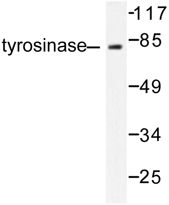 Tyrosinase Antibody - Western blot of Tyrosinase (R501) pAb in extracts from COS7 cells treated with UV 30'.