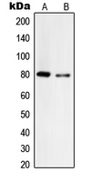 Tyrosinase Antibody - Western blot analysis of Tyrosinase expression in A375 (A); HepG2 (B) whole cell lysates.