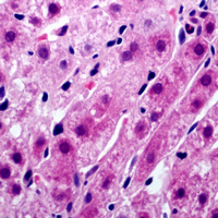 Tyrosinase Antibody - Immunohistochemical analysis of Tyrosinase staining in human liver formalin fixed paraffin embedded tissue section. The section was pre-treated using heat mediated antigen retrieval with sodium citrate buffer (pH 6.0). The section was then incubated with the antibody at room temperature and detected using an HRP conjugated compact polymer system. AEC was used as the chromogen. The section was then counterstained with hematoxylin and mounted with DPX.