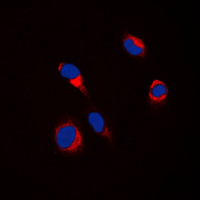 Tyrosinase Antibody - Immunofluorescent analysis of Tyrosinase staining in HepG2 cells. Formalin-fixed cells were permeabilized with 0.1% Triton X-100 in TBS for 5-10 minutes and blocked with 3% BSA-PBS for 30 minutes at room temperature. Cells were probed with the primary antibody in 3% BSA-PBS and incubated overnight at 4 C in a humidified chamber. Cells were washed with PBST and incubated with a DyLight 594-conjugated secondary antibody (red) in PBS at room temperature in the dark. DAPI was used to stain the cell nuclei (blue).