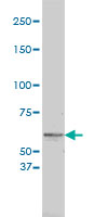 Tyrosinase Antibody - TYR monoclonal antibody (M01), clone 2A2-F4 Western blot of TYR expression in A-431.