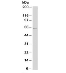 Tyrosinase Antibody - Western blot testing of human A431 cell lysate with Tyrosinase antibody (clone T311). Expected molecular weight: ~60-84kDa depending on glycosylation level. This image was taken for the unmodified form of this product. Other forms have not been tested.