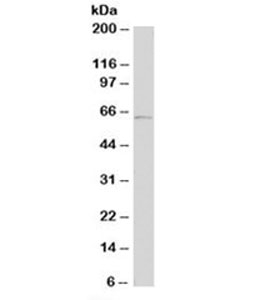 Tyrosinase Antibody - Western blot testing of human A431 cell lysate with Tyrosinase antibody (clone T311). Expected molecular weight: ~60-84kDa depending on glycosylation level.