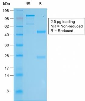 Tyrosinase Antibody - SDS-PAGE Analysis Purified Tyrosinase Rabbit Recombinant Monoclonal Antibody (TYR/2024R). Confirmation of Purity and Integrity of Antibody.