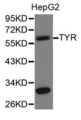 Tyrosinase Antibody - Western blot of HepG2 cell lysate using TYR antibody.