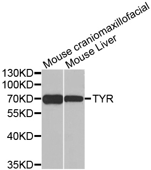 Tyrosinase Antibody - Western blot analysis of extracts of various tissues, using TYR antibody.