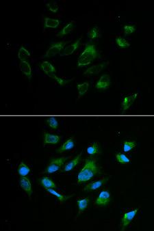 Tyrosinase Antibody - Immunofluorescence analysis of MCF7 cell using TYR antibody. Blue: DAPI for nuclear staining.