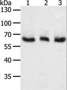 Tyrosinase Antibody - Western blot analysis of A375, HeLa and Jurkat cell, using TYR Polyclonal Antibody at dilution of 1:400.