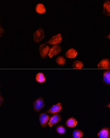 Tyrosinase Antibody - Immunofluorescence analysis of HeLa cells using TYR antibody at dilution of 1:100 (40x lens). Blue: DAPI for nuclear staining.