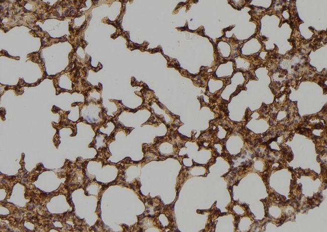 Tyrosinase Antibody - 1:100 staining mouse lung tissue by IHC-P. The sample was formaldehyde fixed and a heat mediated antigen retrieval step in citrate buffer was performed. The sample was then blocked and incubated with the antibody for 1.5 hours at 22°C. An HRP conjugated goat anti-rabbit antibody was used as the secondary.