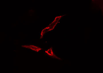Tyrosinase Antibody - Staining HeLa cells by IF/ICC. The samples were fixed with PFA and permeabilized in 0.1% Triton X-100, then blocked in 10% serum for 45 min at 25°C. The primary antibody was diluted at 1:200 and incubated with the sample for 1 hour at 37°C. An Alexa Fluor 594 conjugated goat anti-rabbit IgG (H+L) antibody, diluted at 1/600, was used as secondary antibody.